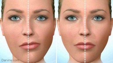 درباره تقارن صورت و روش درمان آن بدانید