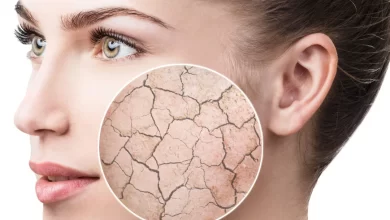 ترفند خانگی عالی برای جلوگیری از خشکی پوست